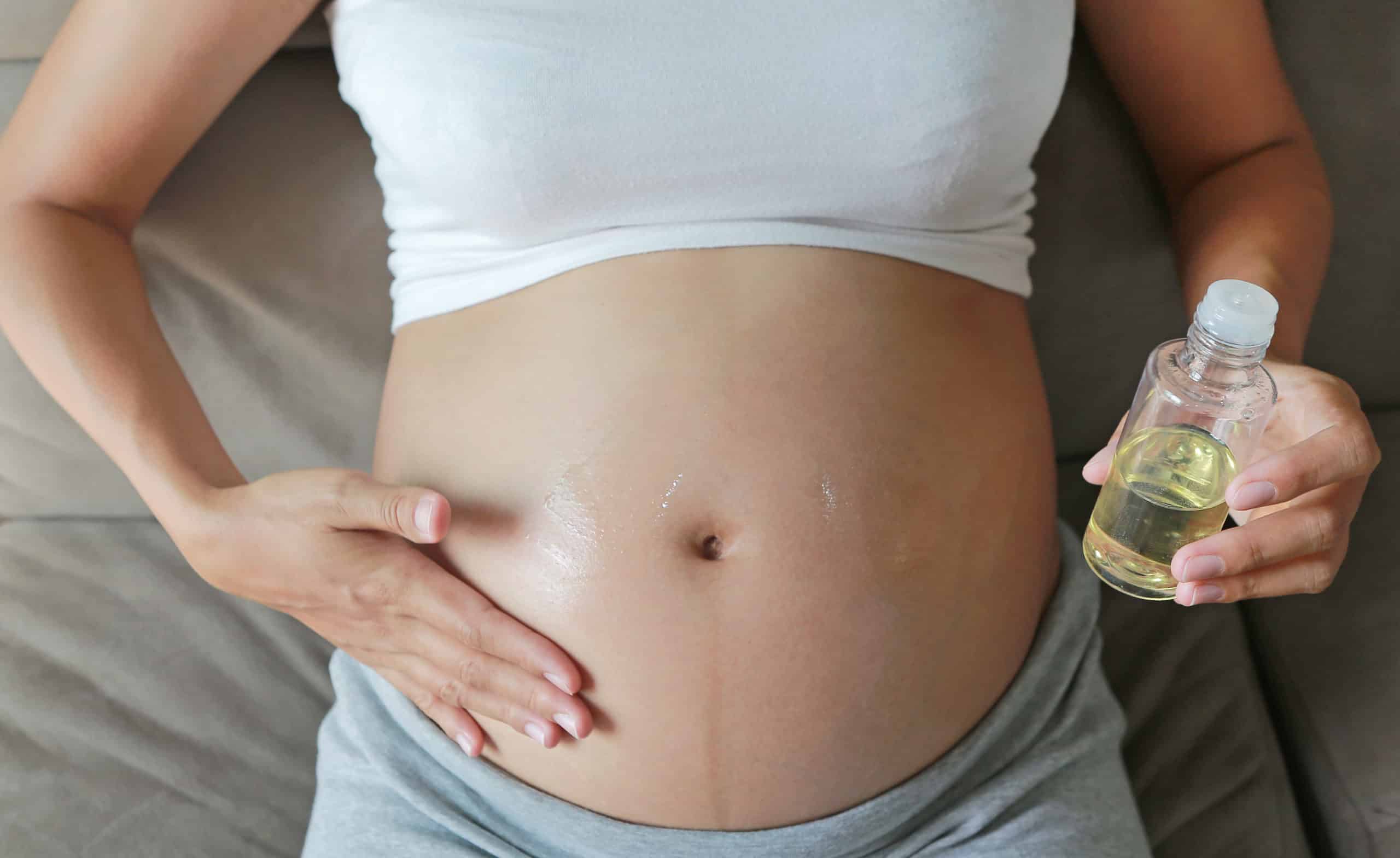 Solved: How to Get Rid of Stretch Marks After Pregnancy Dominion